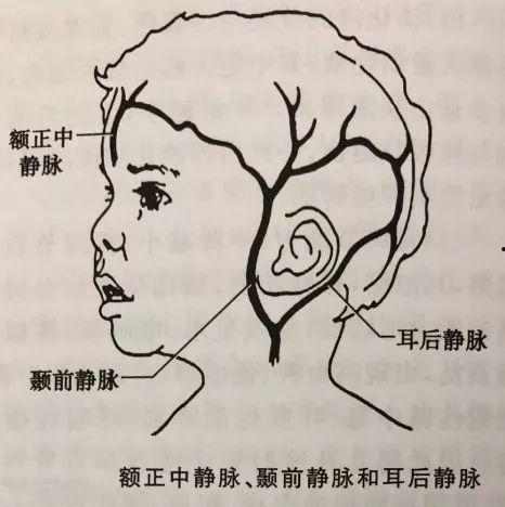 小儿头皮静脉穿刺视频,小儿头皮静脉穿刺操作步骤及要点解析